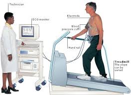 ECG